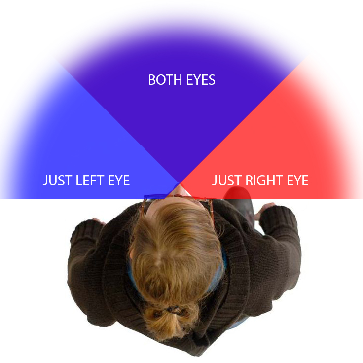 binocular vision dysfunction