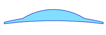 Shape #11: Lenticular A high base curve “bowl” on a flatter carrier lens. Can be done free-form or using standard semi-finished lenses.