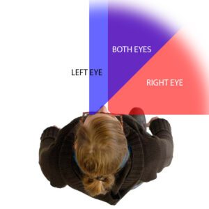 Visual field diagram showing hemianopic vision