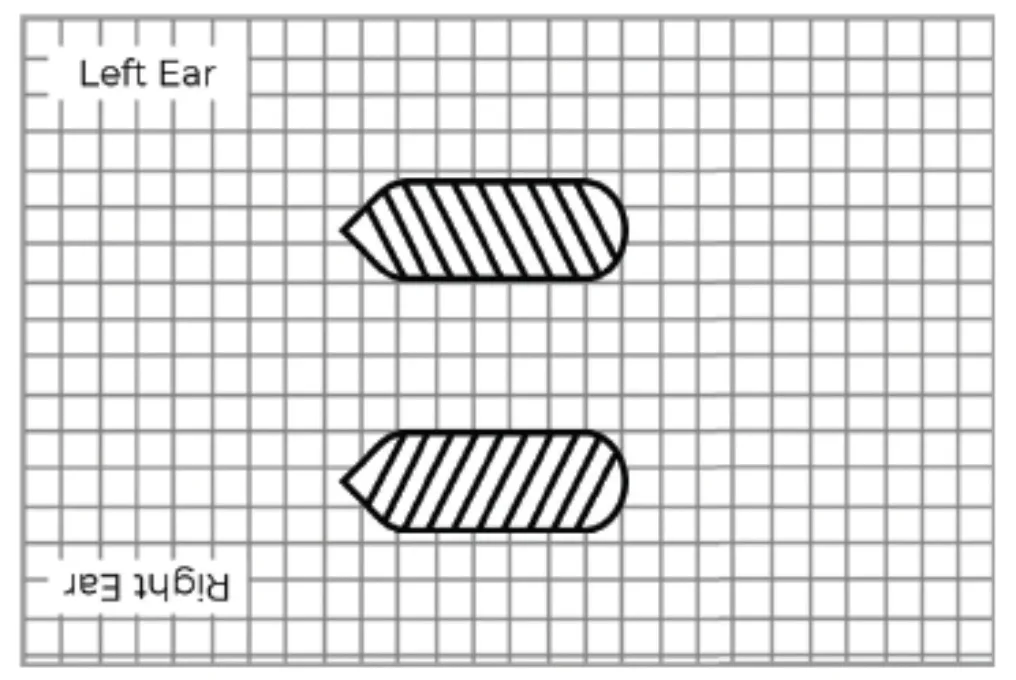 Grid diagram showing left and right ear positions with two striped arrows pointing towards the center.