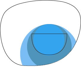 Illustration of a freeform trifocal lens showing layered blue segments, representing different focal zones within the lens.