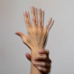 Overlaid image of a hand raised with fingers spread, illustrating the double vision effect often associated with binocular vision dysfunction.