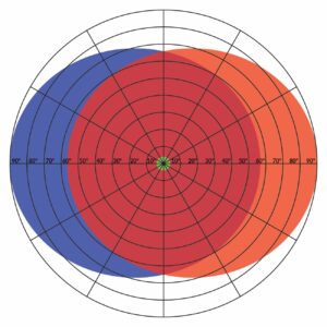 Visual-Field-Chadwick_Optical