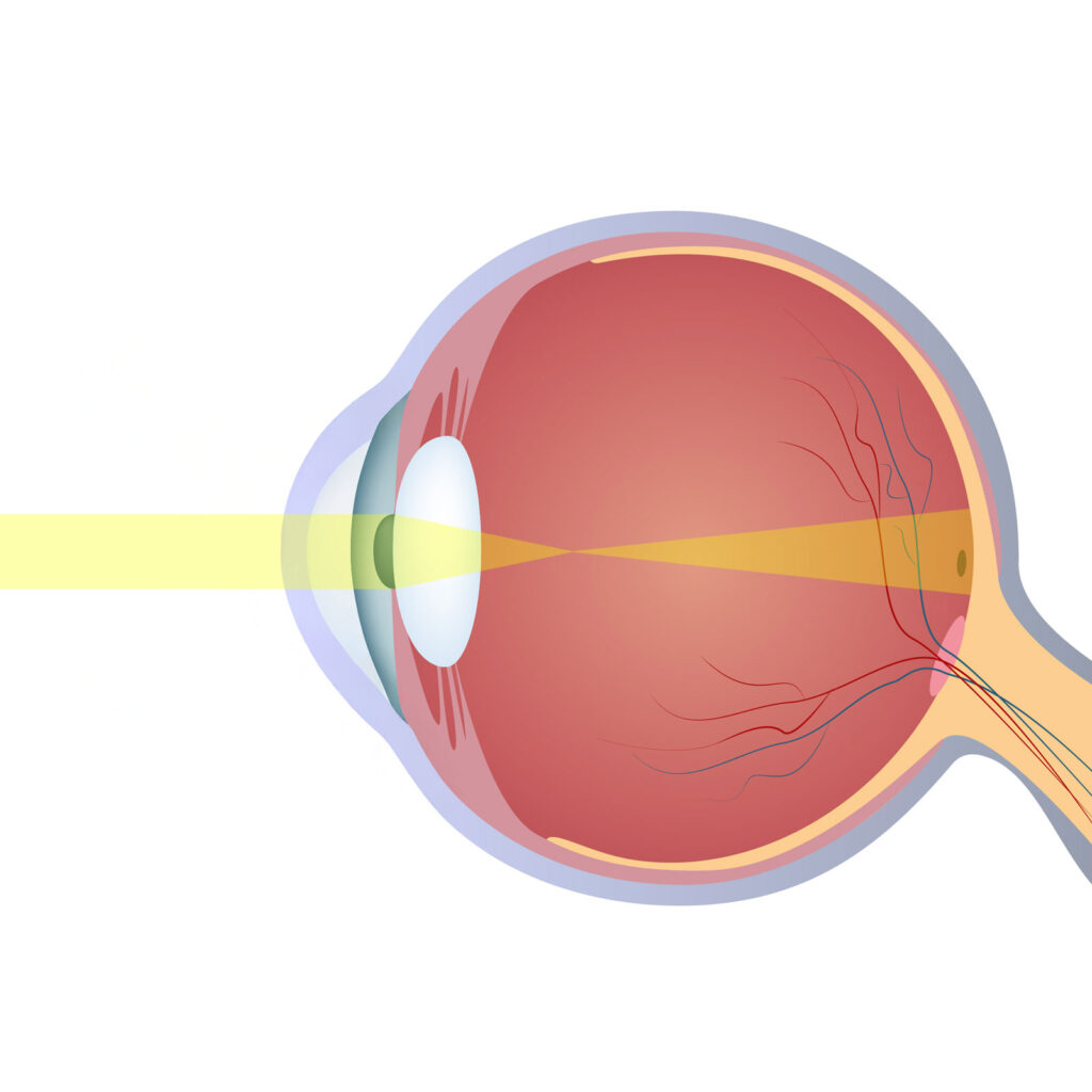 chadwick-optical-principles-of-vision-eye-side-view