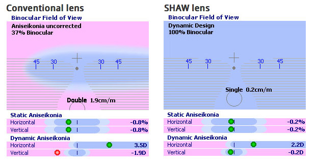 hardcore-optometry-Shaw-Lens-Chadwick-Optical Field of View Charts for the SHAW™ Lenses from Chadwick Optical