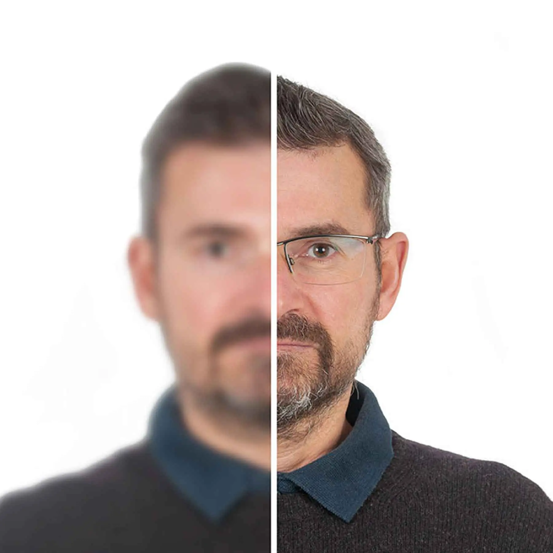 Chadwick Optical's lens tech: clarity for those with vision loss, helping patients regain sharp focus and live confidently.