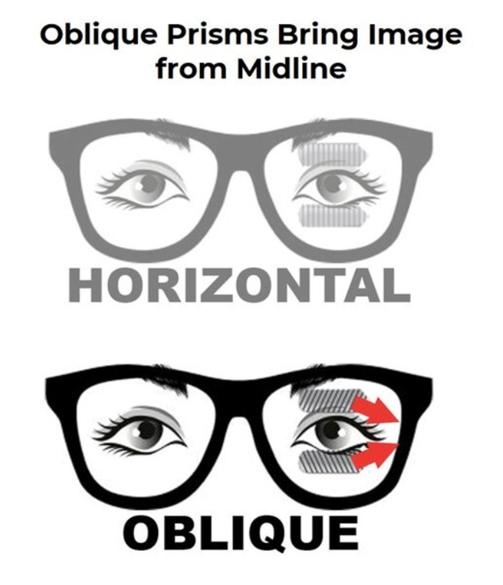 Oblique Prisms: Helping patients see beyond midline, preventing missed steps and enhancing peripheral awareness.