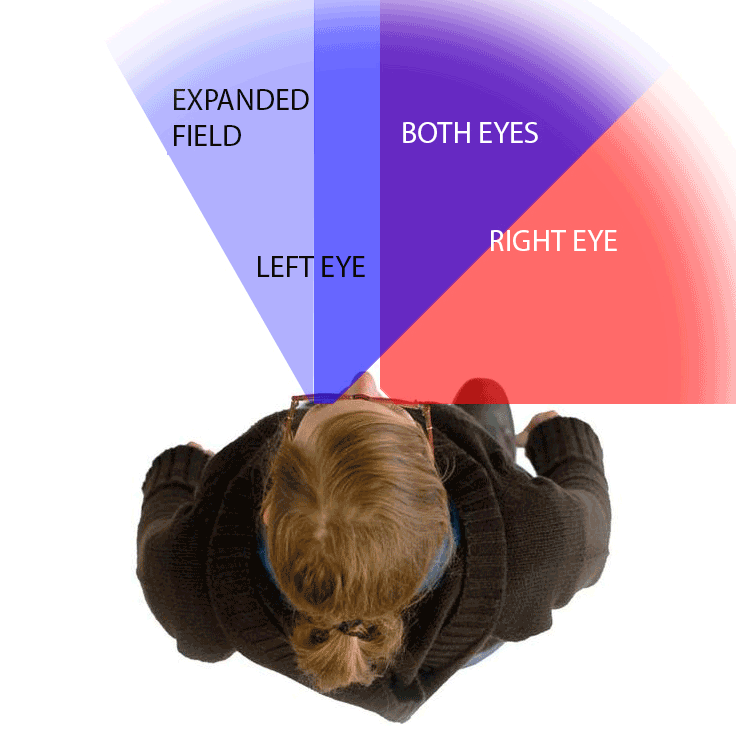 Chadwick Optical's field expanders help people see their sides again, restoring wide vision and reducing missed moments.