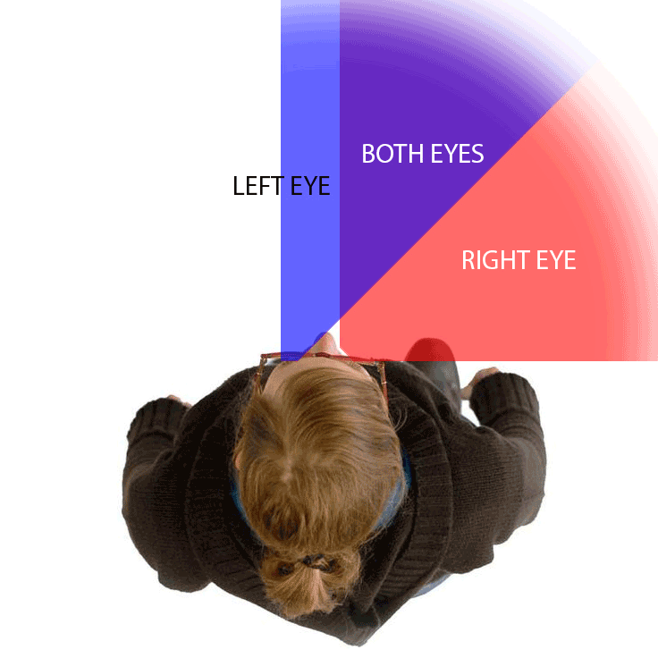 Prism lenses align vision, helping people regain full field sight and stop missing what's on their side.
