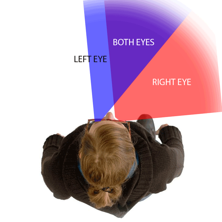Chadwick Optical's VTS Prism Lens: Solves vision field loss, helping regain sight from both eyes and prevent falls.