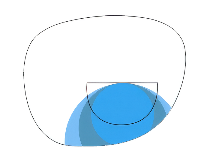ff-bifocal