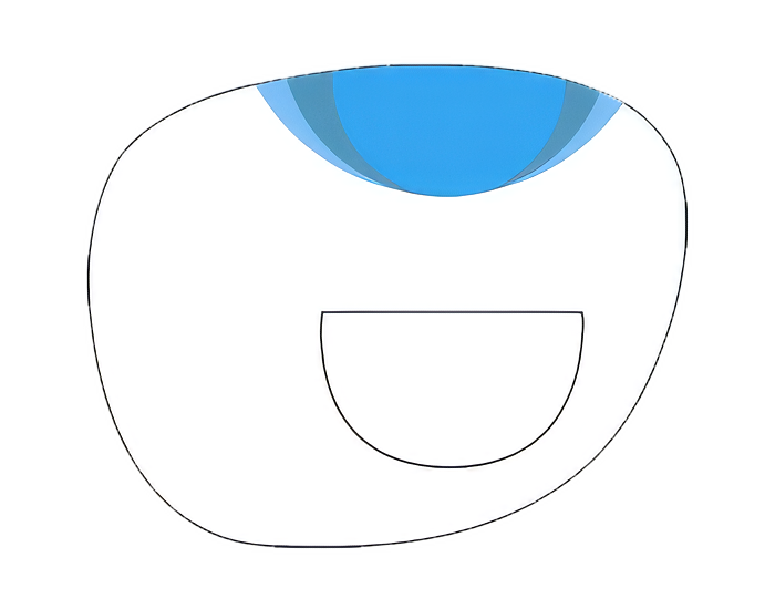 ftroundoccup